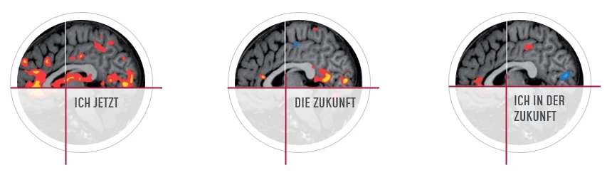 HiLo_Agency_Eltville Dopamin_DE